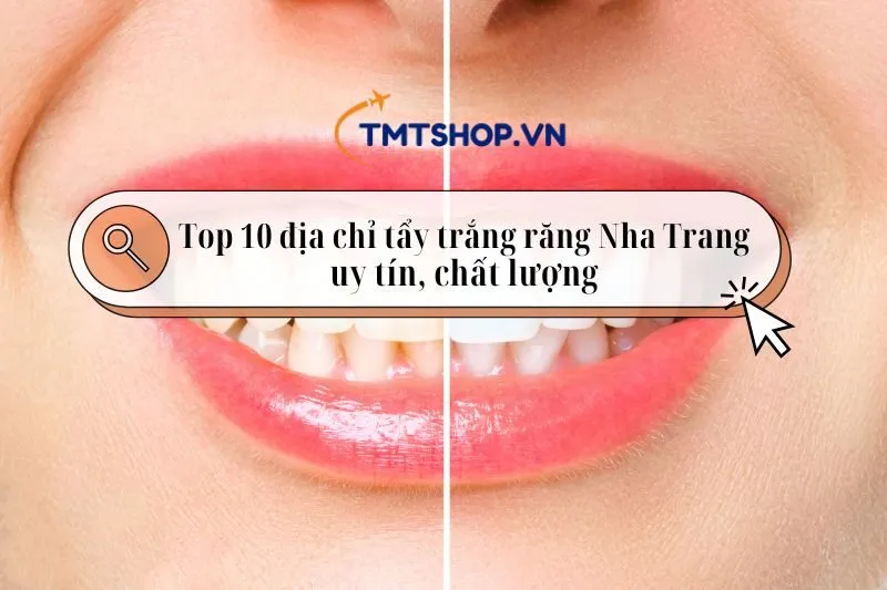 Top 10 địa chỉ tẩy trắng răng Nha Trang uy tín, chất lượng 2025